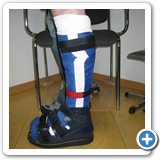 5. Der fertige Total Contact Cast im Verbandschuh, (Abrollso